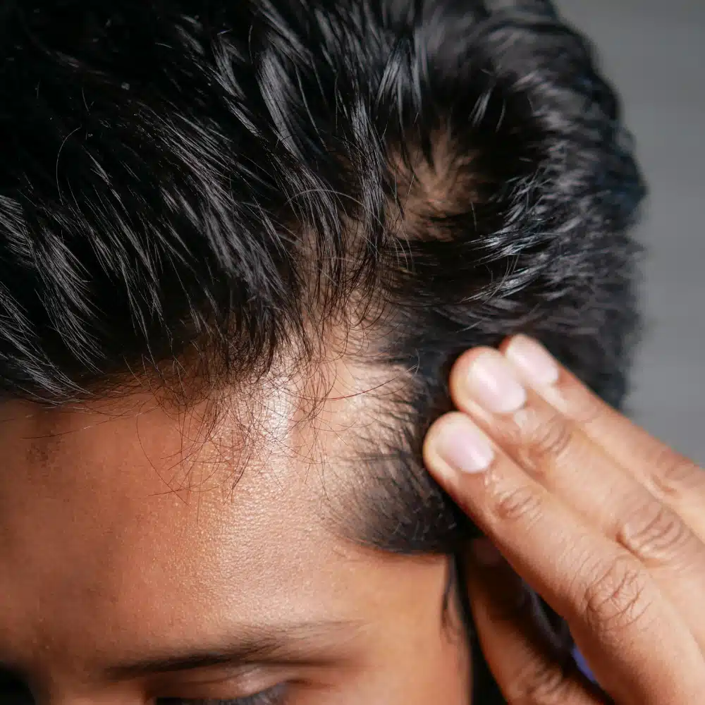 fix male hair loss