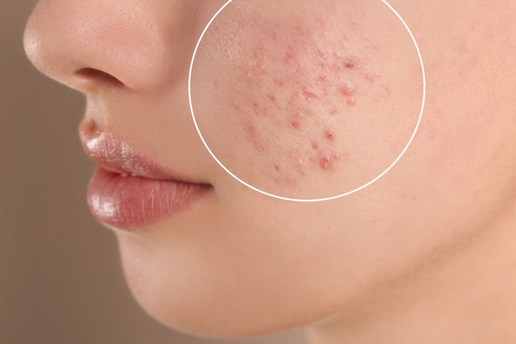 dermatology services patient