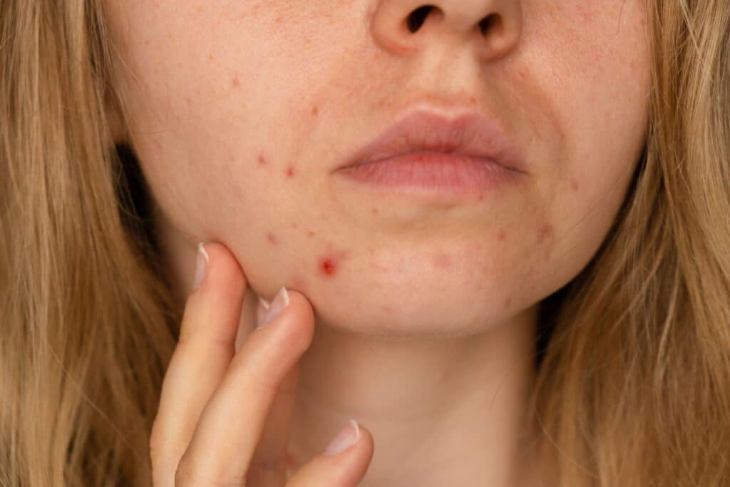 dermatology services patient