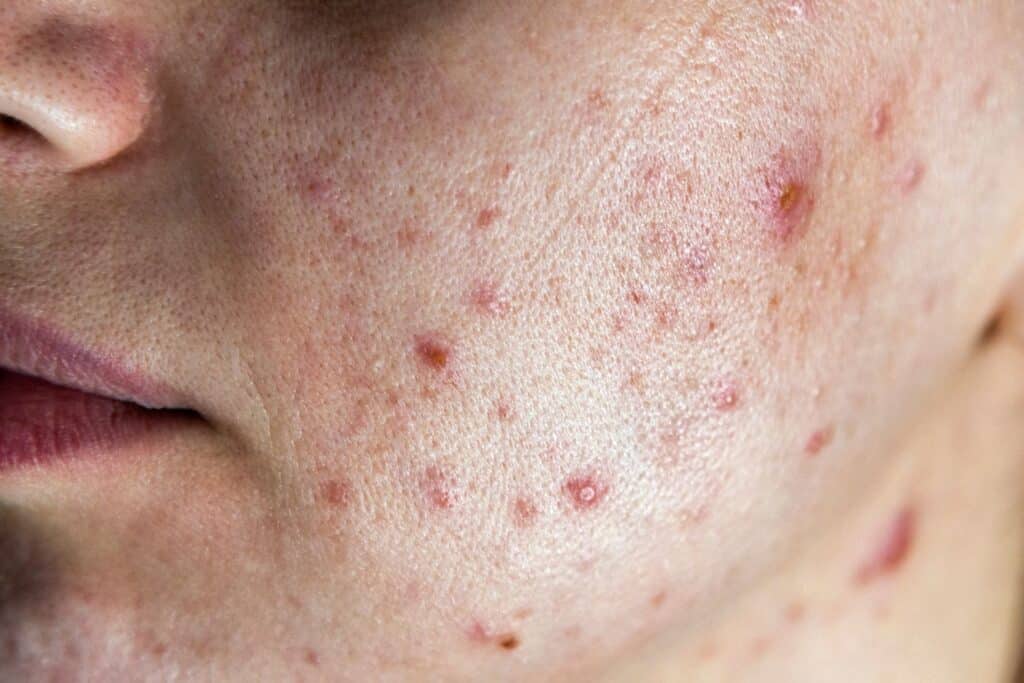 dermatology services patient