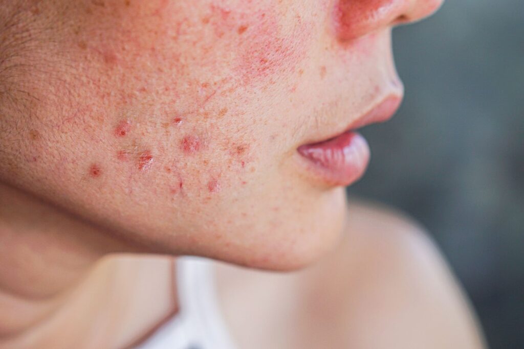 dermatology services patient