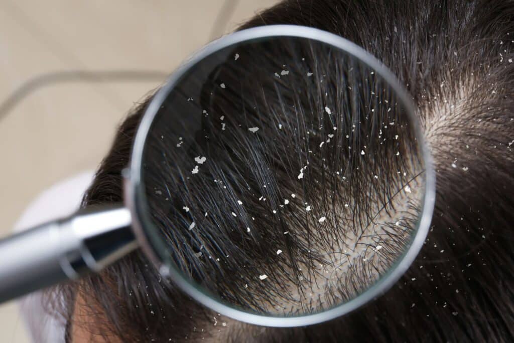 dermatology services patient