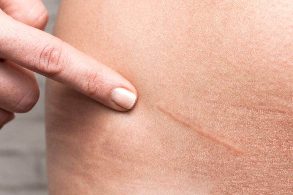 dermatology services patient