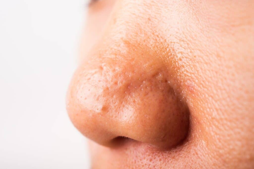 dermatology services patient