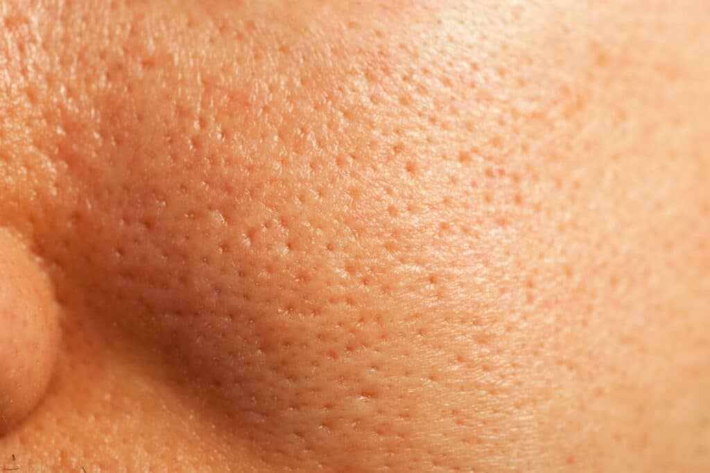 dermatology services patient