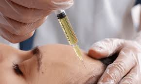 plasma-rich platelet injection