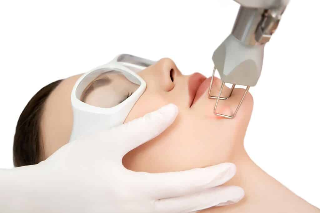 CO2 laser procedures