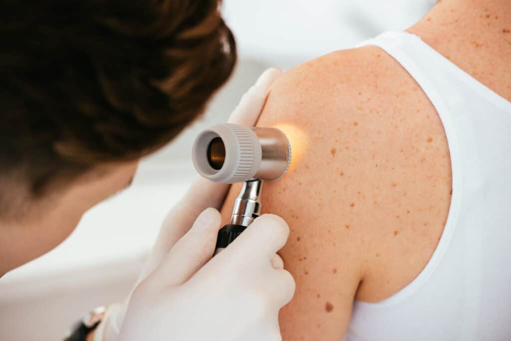 skin cancer dermatologist