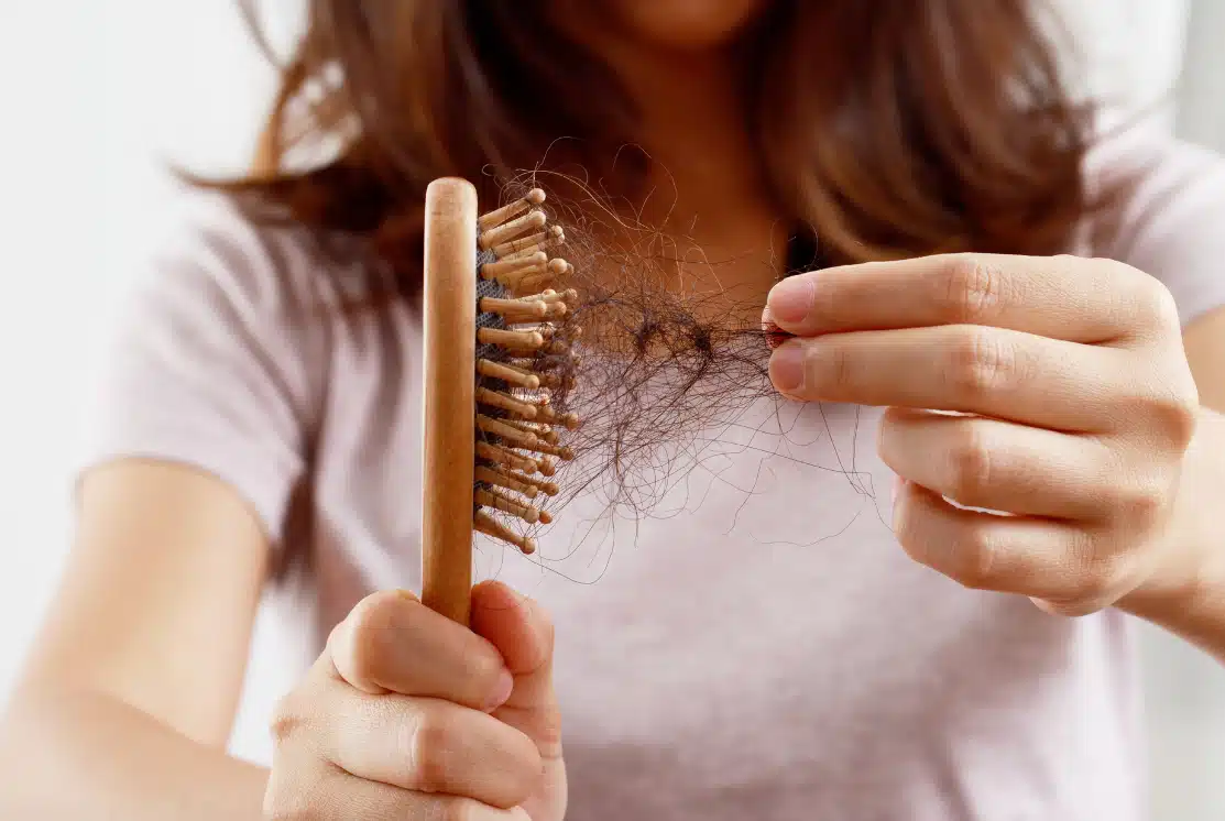 best dermatologist for hair loss