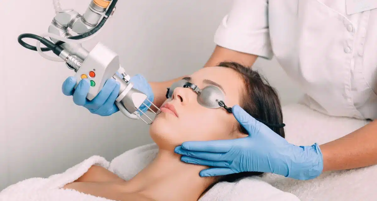 CO2 laser procedure